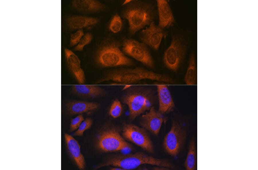Immunofluorescence - Anti-Laminin beta 1 Antibody [ARC0985] (A306424) - Antibodies.com