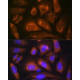 Immunofluorescence - Anti-Laminin beta 1 Antibody [ARC0985] (A306424) - Antibodies.com