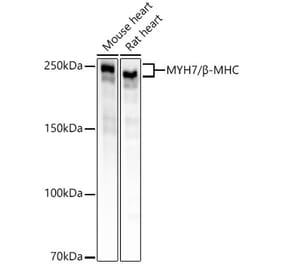 Western Blot - Anti-Slow Skeletal Myosin Heavy chain Antibody [ARC55749] (A306426) - Antibodies.com