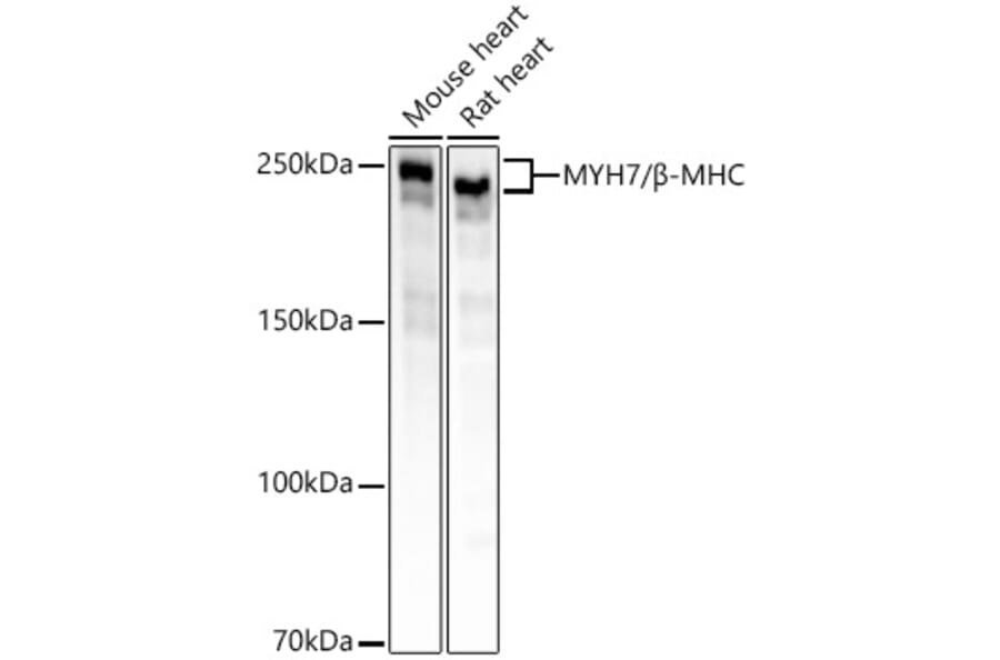 Western Blot - Anti-Slow Skeletal Myosin Heavy chain Antibody [ARC55749] (A306426) - Antibodies.com