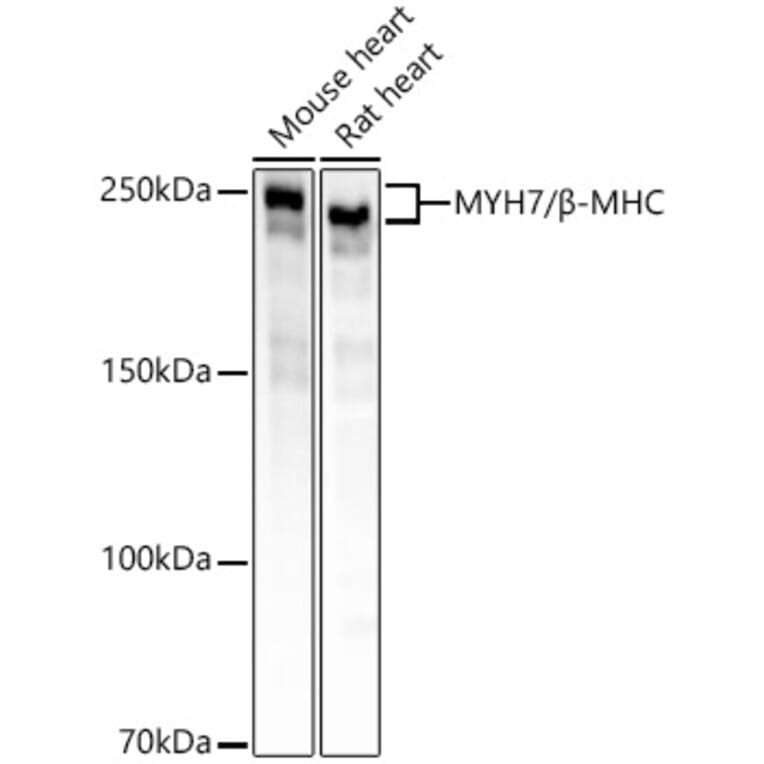 Western Blot - Anti-Slow Skeletal Myosin Heavy chain Antibody [ARC55749] (A306426) - Antibodies.com