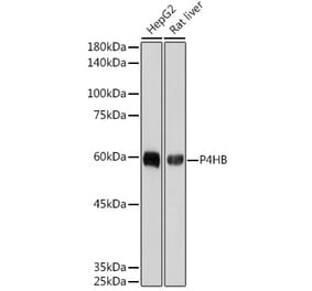 Western Blot - Anti-P4HB Antibody [ARC2398] (A306427) - Antibodies.com