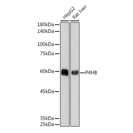 Western Blot - Anti-P4HB Antibody [ARC2398] (A306427) - Antibodies.com