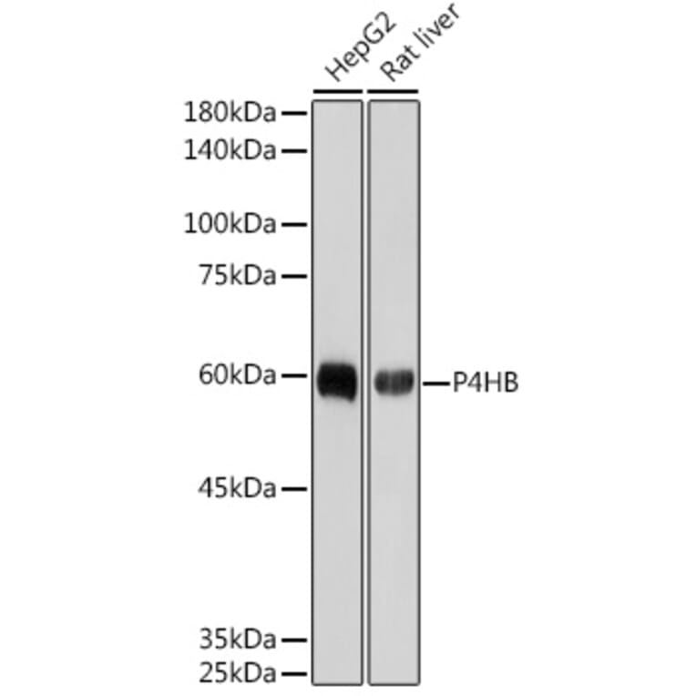 Western Blot - Anti-P4HB Antibody [ARC2398] (A306427) - Antibodies.com