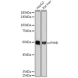 Western Blot - Anti-P4HB Antibody [ARC2398] (A306427) - Antibodies.com