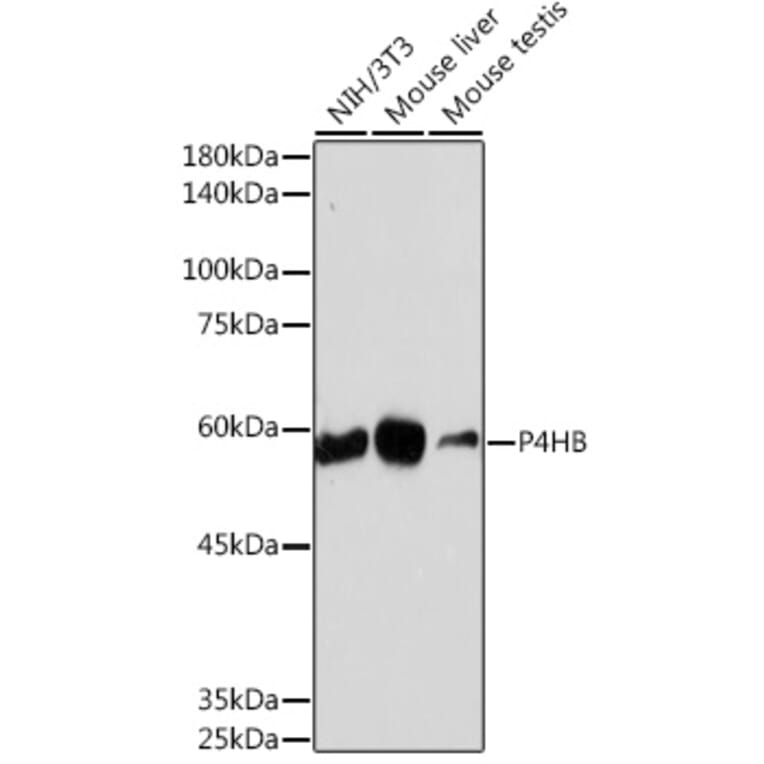 Western Blot - Anti-P4HB Antibody [ARC2398] (A306427) - Antibodies.com