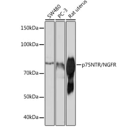 Western Blot - Anti-p75 NGF Receptor Antibody [ARC0284] (A306428) - Antibodies.com