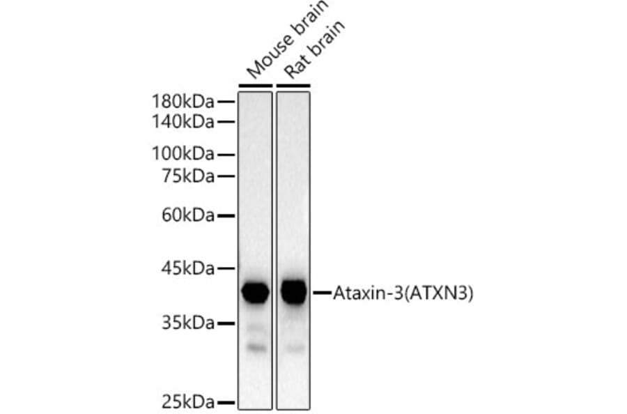 Western Blot - Anti-Ataxin 3 Antibody [ARC54882] (A306429) - Antibodies.com
