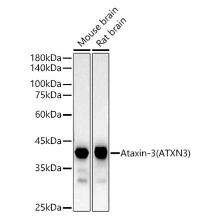 Western Blot - Anti-Ataxin 3 Antibody [ARC54882] (A306429) - Antibodies.com