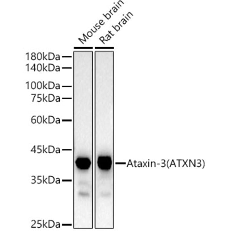 Western Blot - Anti-Ataxin 3 Antibody [ARC54882] (A306429) - Antibodies.com