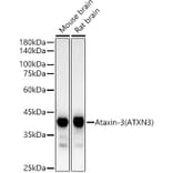 Western Blot - Anti-Ataxin 3 Antibody [ARC54882] (A306429) - Antibodies.com