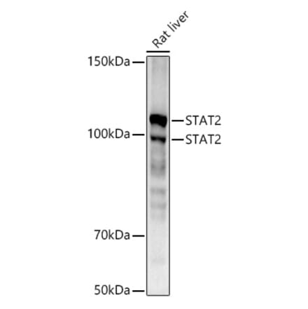 Western Blot - Anti-STAT2 Antibody [ARC51796] (A306433) - Antibodies.com