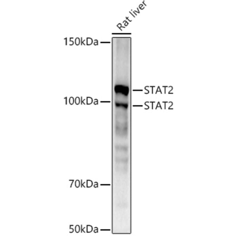 Western Blot - Anti-STAT2 Antibody [ARC51796] (A306433) - Antibodies.com