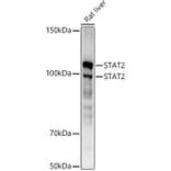 Western Blot - Anti-STAT2 Antibody [ARC51796] (A306433) - Antibodies.com