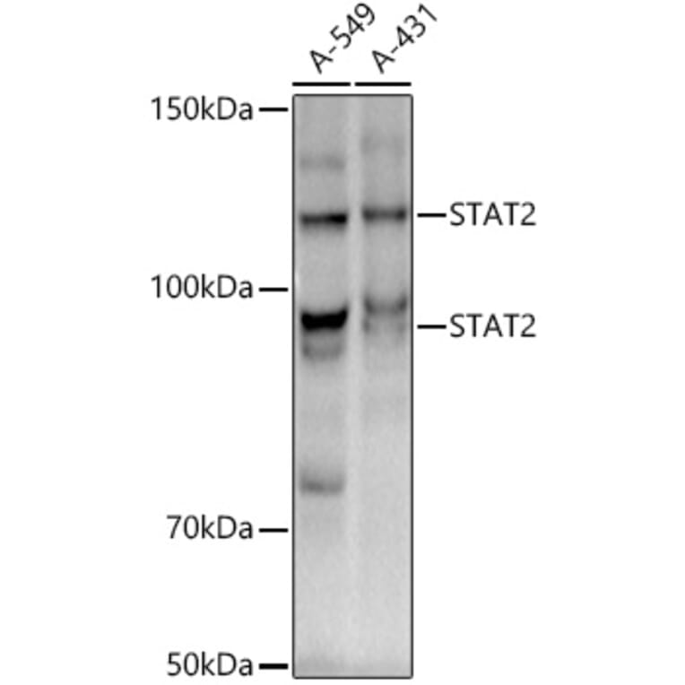 Western Blot - Anti-STAT2 Antibody [ARC51796] (A306433) - Antibodies.com
