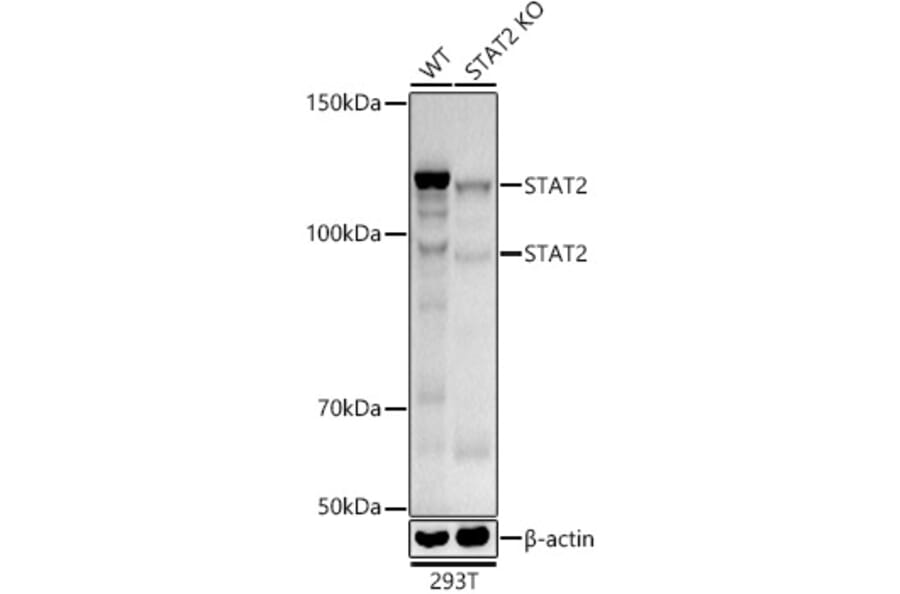 Western Blot - Anti-STAT2 Antibody [ARC51796] (A306433) - Antibodies.com