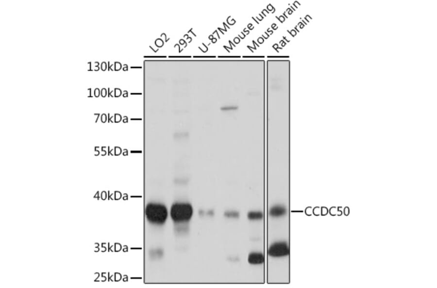 Western Blot - Anti-CCDC50 Antibody (A306434) - Antibodies.com