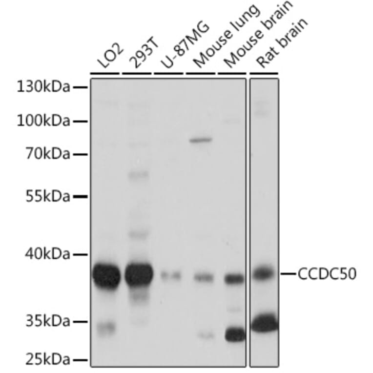 Western Blot - Anti-CCDC50 Antibody (A306434) - Antibodies.com