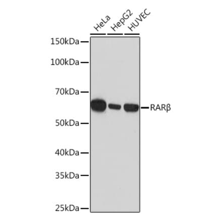 Western Blot - Anti-Retinoic Acid Receptor beta Antibody [ARC1024] (A306435) - Antibodies.com