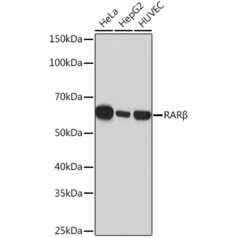 Western Blot - Anti-Retinoic Acid Receptor beta Antibody [ARC1024] (A306435) - Antibodies.com