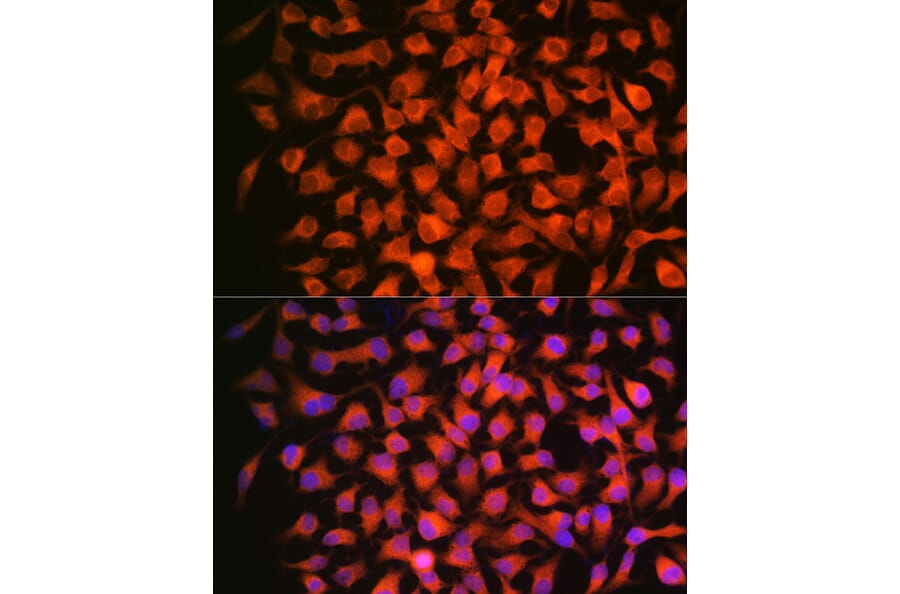 Immunofluorescence - Anti-Retinoic Acid Receptor beta Antibody [ARC1024] (A306435) - Antibodies.com
