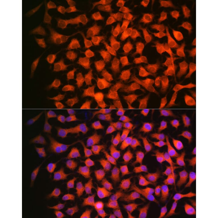 Immunofluorescence - Anti-Retinoic Acid Receptor beta Antibody [ARC1024] (A306435) - Antibodies.com