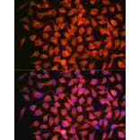 Immunofluorescence - Anti-Retinoic Acid Receptor beta Antibody [ARC1024] (A306435) - Antibodies.com