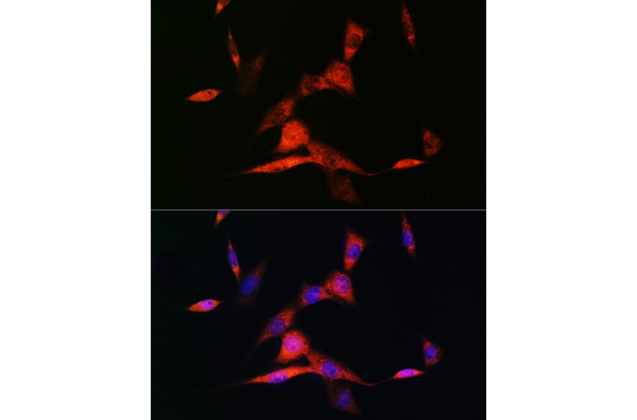 Immunofluorescence - Anti-Retinoic Acid Receptor beta Antibody [ARC1024] (A306435) - Antibodies.com
