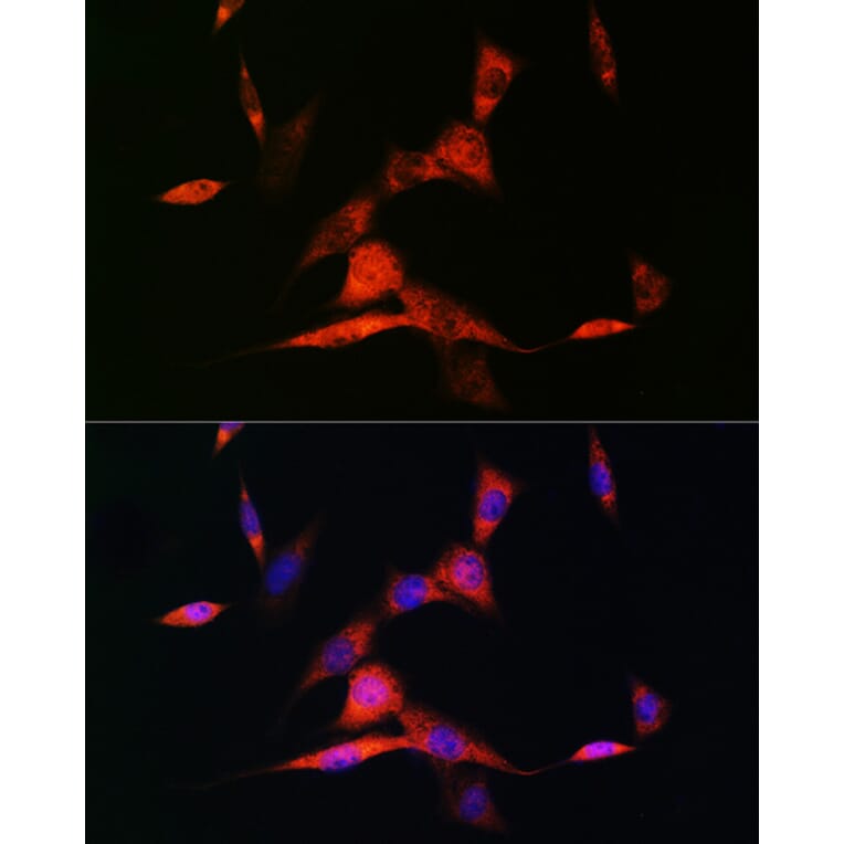 Immunofluorescence - Anti-Retinoic Acid Receptor beta Antibody [ARC1024] (A306435) - Antibodies.com