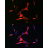 Immunofluorescence - Anti-Retinoic Acid Receptor beta Antibody [ARC1024] (A306435) - Antibodies.com