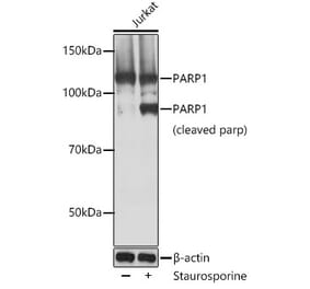 Western Blot - Anti-PARP1 Antibody [ARC0075] (A306436) - Antibodies.com
