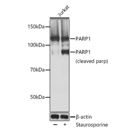 Western Blot - Anti-PARP1 Antibody [ARC0075] (A306436) - Antibodies.com