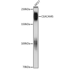 Western Blot - Anti-CEACAM5 Antibody [AMC0141] (A306438) - Antibodies.com