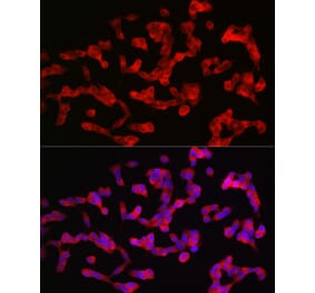 Immunofluorescence - Anti-ANK-3 Antibody (A306440) - Antibodies.com