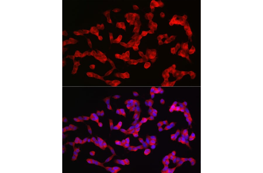 Immunofluorescence - Anti-ANK-3 Antibody (A306440) - Antibodies.com