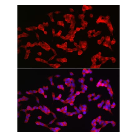 Immunofluorescence - Anti-ANK-3 Antibody (A306440) - Antibodies.com