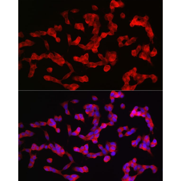 Immunofluorescence - Anti-ANK-3 Antibody (A306440) - Antibodies.com