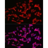 Immunofluorescence - Anti-ANK-3 Antibody (A306440) - Antibodies.com