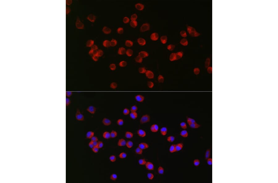 Immunofluorescence - Anti-ANK-3 Antibody (A306440) - Antibodies.com
