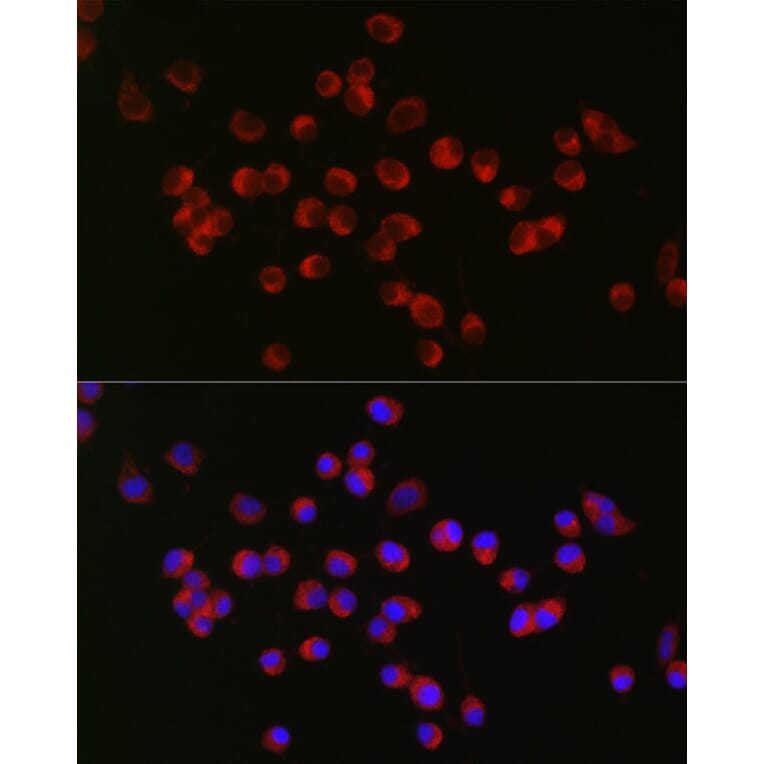 Immunofluorescence - Anti-ANK-3 Antibody (A306440) - Antibodies.com