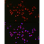 Immunofluorescence - Anti-ANK-3 Antibody (A306440) - Antibodies.com
