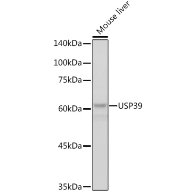 Western Blot - Anti-USP39 Antibody [ARC2588] (A306442) - Antibodies.com