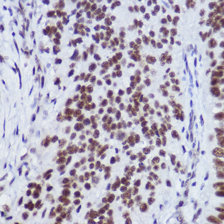 Immunohistochemistry - Anti-USP39 Antibody [ARC2588] (A306442) - Antibodies.com