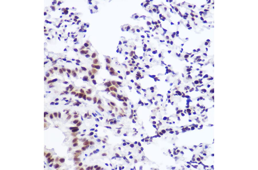Immunohistochemistry - Anti-USP39 Antibody [ARC2588] (A306442) - Antibodies.com