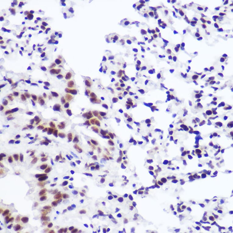 Immunohistochemistry - Anti-USP39 Antibody [ARC2588] (A306442) - Antibodies.com