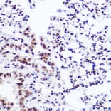 Immunohistochemistry - Anti-USP39 Antibody [ARC2588] (A306442) - Antibodies.com