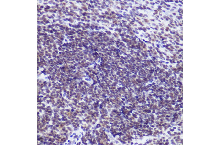 Immunohistochemistry - Anti-USP39 Antibody [ARC2588] (A306442) - Antibodies.com
