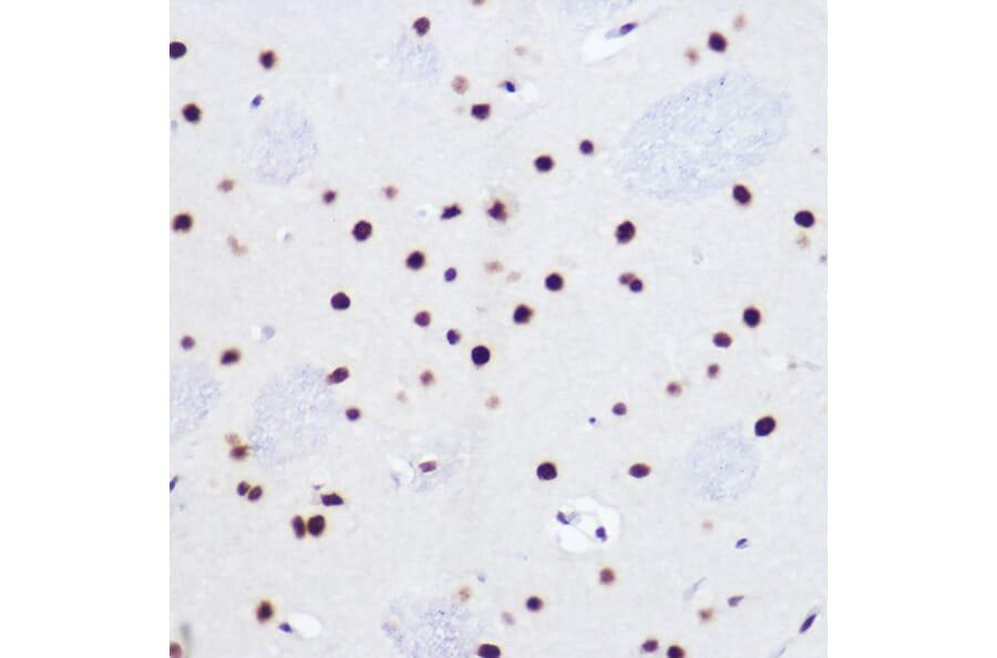 Immunohistochemistry - Anti-USP39 Antibody [ARC2588] (A306442) - Antibodies.com
