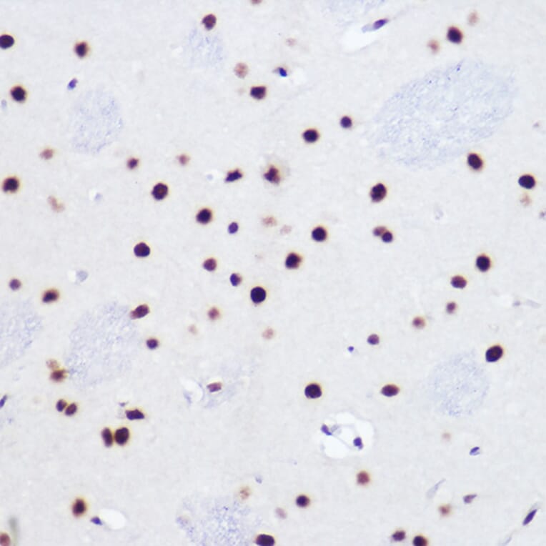 Immunohistochemistry - Anti-USP39 Antibody [ARC2588] (A306442) - Antibodies.com