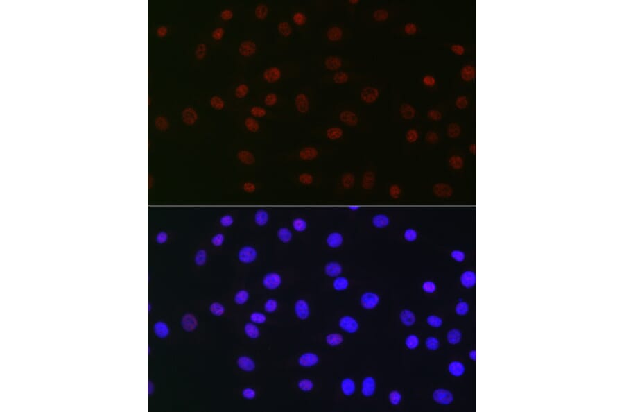 Immunofluorescence - Anti-USP39 Antibody [ARC2588] (A306442) - Antibodies.com